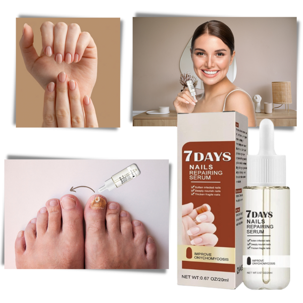 7 Days Nail Repair Essence | Style and Practicality Finally Together — The Modern Home Essential