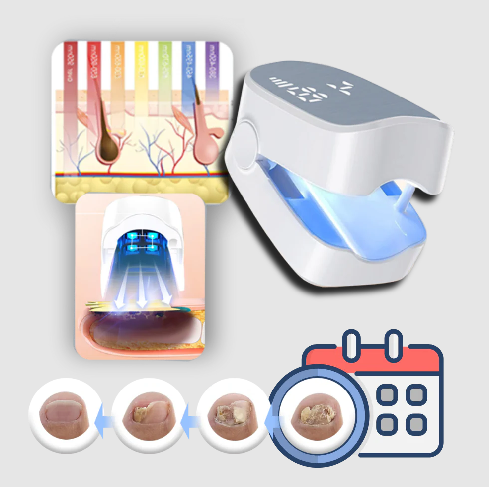 Painless Nail Fungus Laser | Clinically Designed for Targeted Pain Relief & Faster Daily Recovery