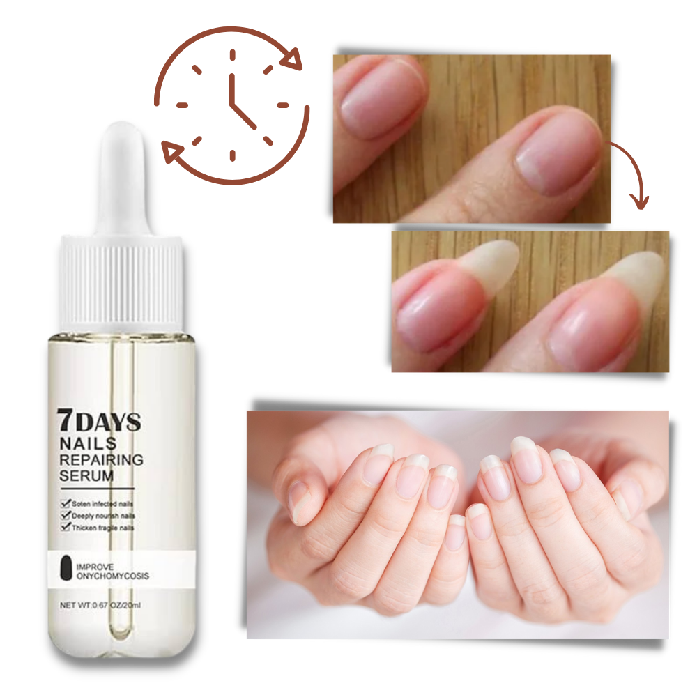 7 Days Nail Repair Essence | Style and Practicality Finally Together — The Modern Home Essential