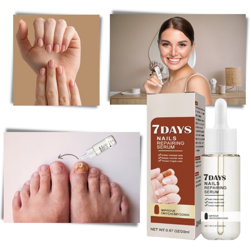 7 Days Nail Repair Essence | Style and Practicality Finally Together — The Modern Home Essential
