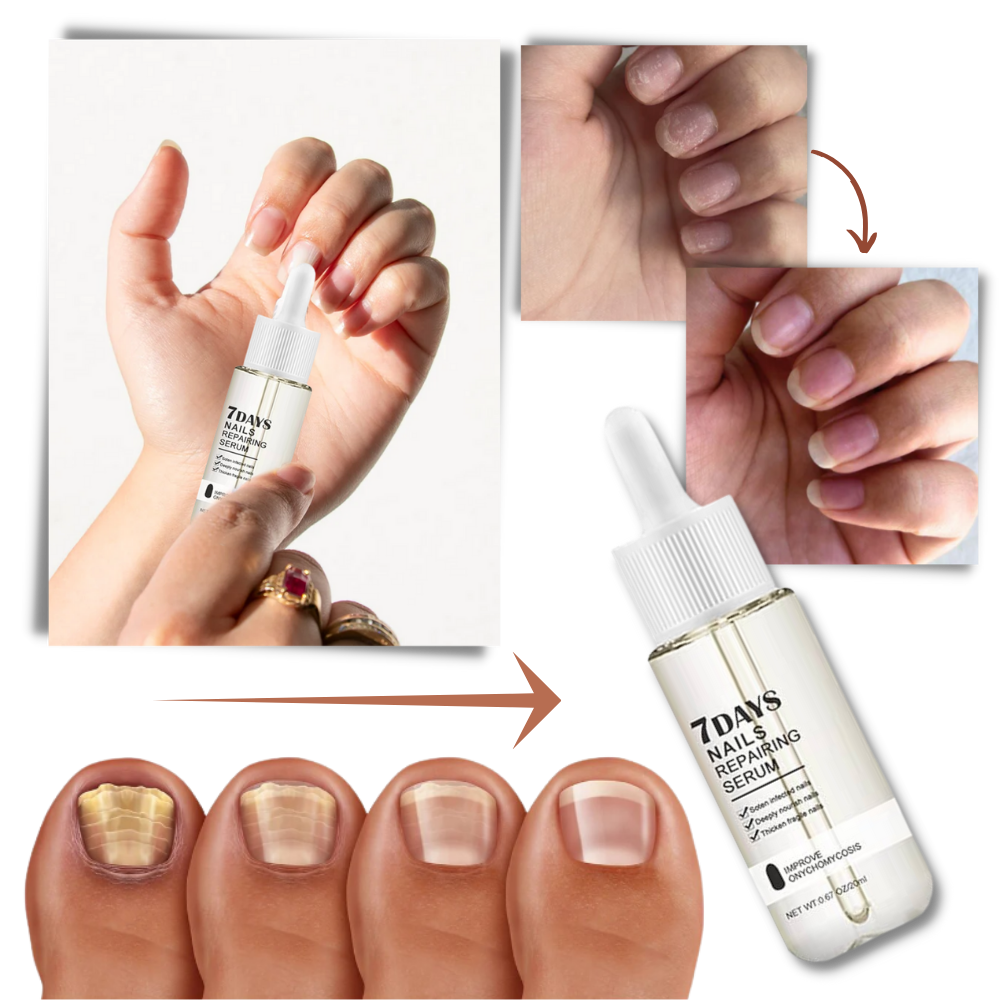 7 Days Nail Repair Essence | Style and Practicality Finally Together — The Modern Home Essential