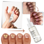 7 Days Nail Repair Essence | Style and Practicality Finally Together — The Modern Home Essential