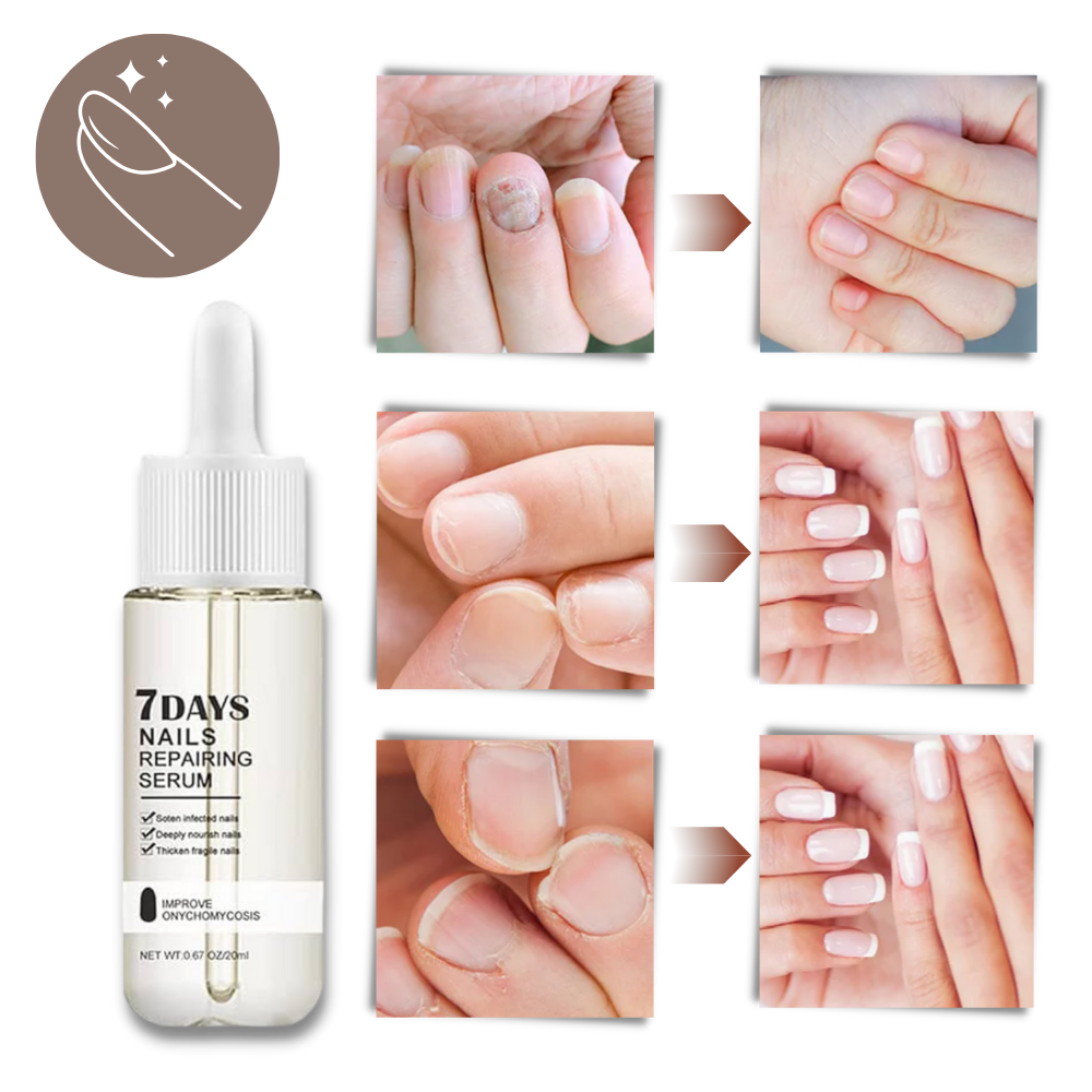 7 Days Nail Repair Essence | Style and Practicality Finally Together — The Modern Home Essential