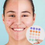 Hydrocolloid Pimple Acne Patch Sticker | Practical, Durable & Designed to Make Everyday Life Easier