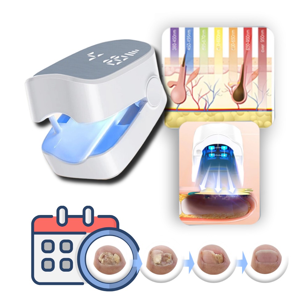 Painless laser treatment for nail fungus | Clinically Designed for Targeted Pain Relief & Faster Daily Recovery
