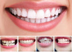 Invisible Dental Realignment Tray | Cleverly Designed for Everyday Use — You'll Wonder How You Managed Without It