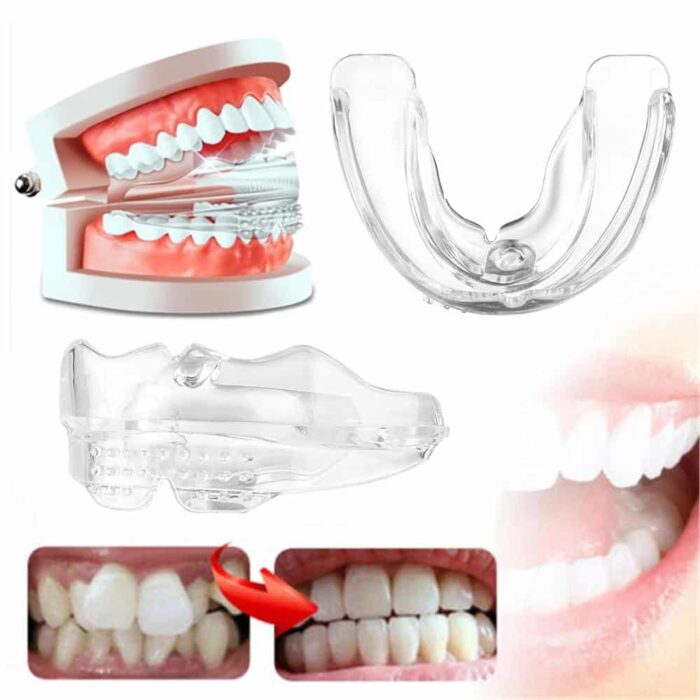 Invisible Dental Realignment Tray | Cleverly Designed for Everyday Use — You'll Wonder How You Managed Without It