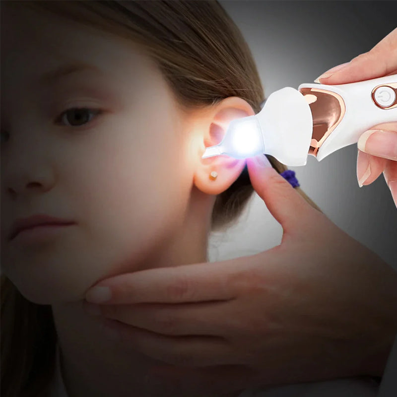 5 in 1 Electric Earwax Remover | Clinically Designed for Targeted Pain Relief & Faster Daily Recovery