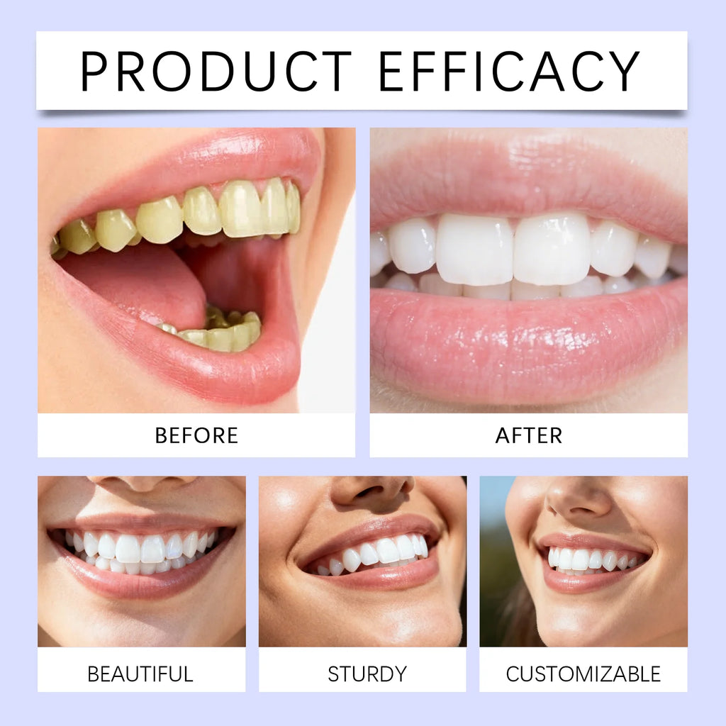 Purple Teeth Whitening Strips | V34 Colour Corrector for Visibly Whiter Teeth in 14 Days