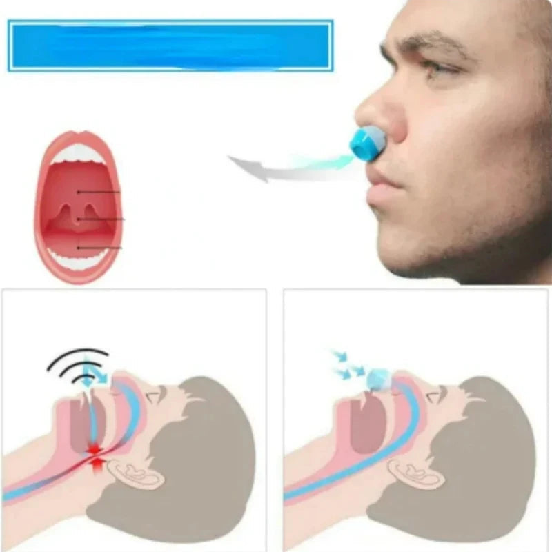 2-in-1 Anti Snore Device and Air Purifier Nose Clip | Doctor-Recommended Support for Pain Relief, Recovery & Mobility
