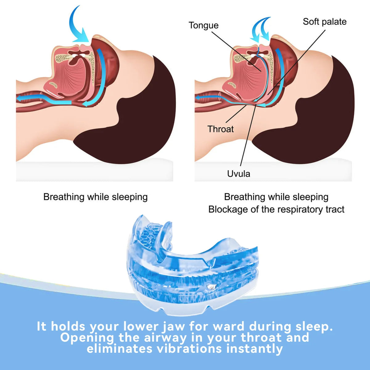 Adjustable Anti Snore Mouthpiece | Clinically Designed for Targeted Pain Relief & Faster Daily Recovery