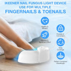 Nail Fungus Laser | Support Your Body, Reclaim Your Comfort & Move More Freely Every Day