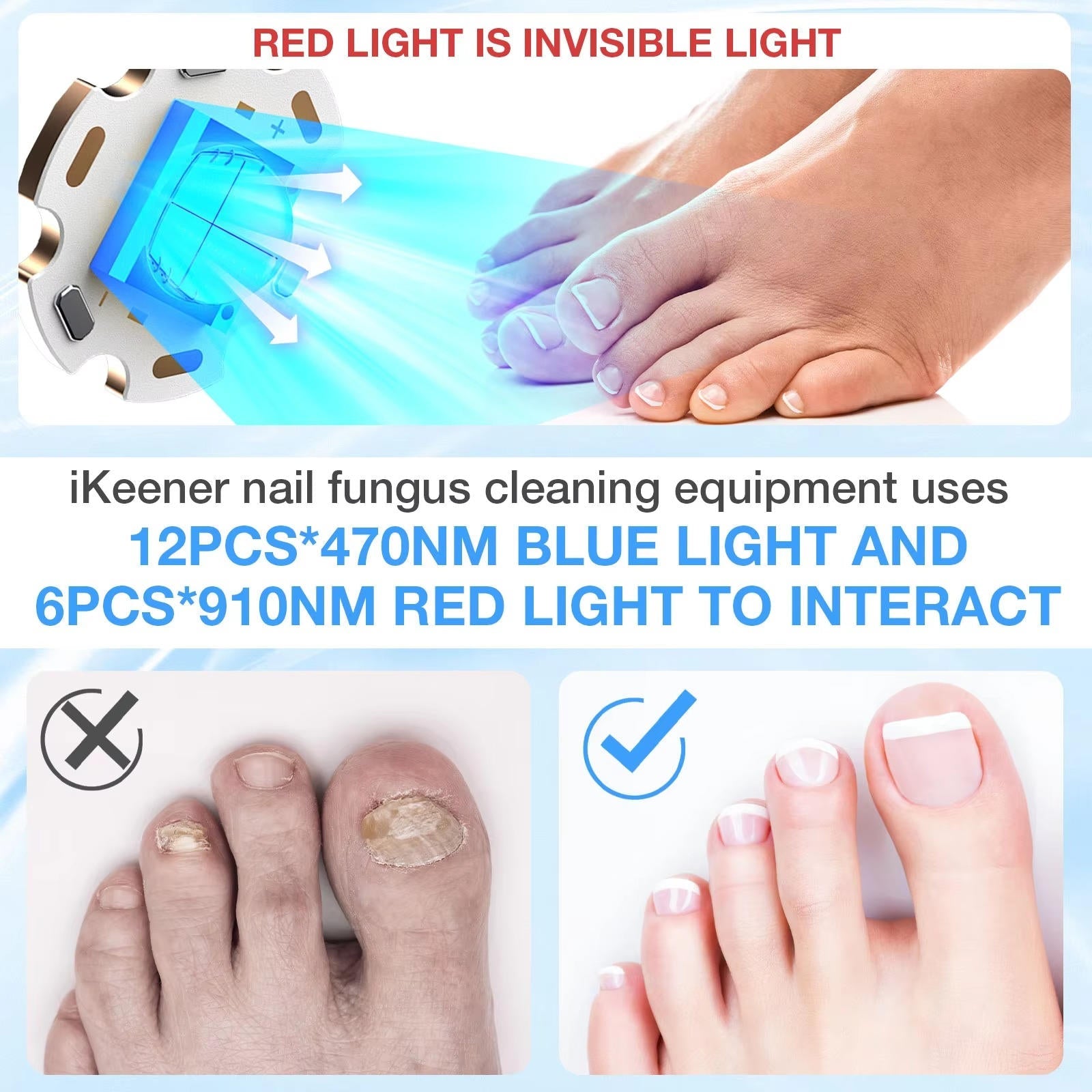 Nail Fungus Laser | Support Your Body, Reclaim Your Comfort & Move More Freely Every Day