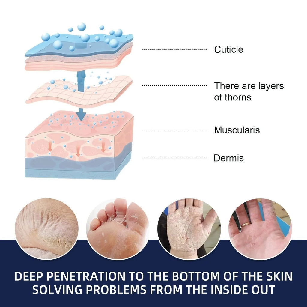 Cracked Foot Heel Treatment 3 Pack | Visible Results Skincare for Radiant, Hydrated, Healthy-Looking Skin