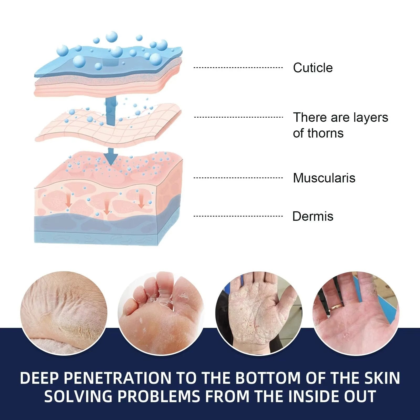 Cracked Foot Heel Treatment 3 Pack | Visible Results Skincare for Radiant, Hydrated, Healthy-Looking Skin