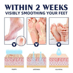 Cracked Foot Heel Treatment 3 Pack | Visible Results Skincare for Radiant, Hydrated, Healthy-Looking Skin