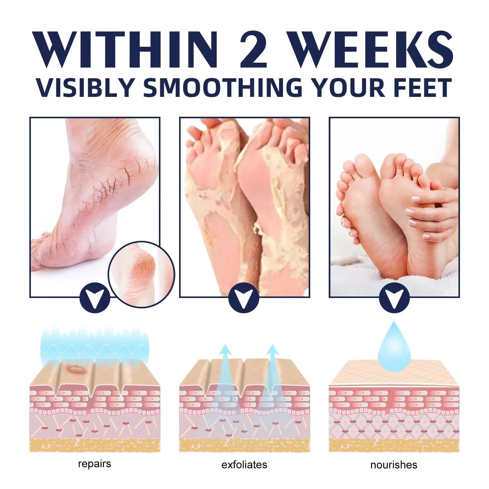 Cracked Foot Heel Treatment 3 Pack | Visible Results Skincare for Radiant, Hydrated, Healthy-Looking Skin