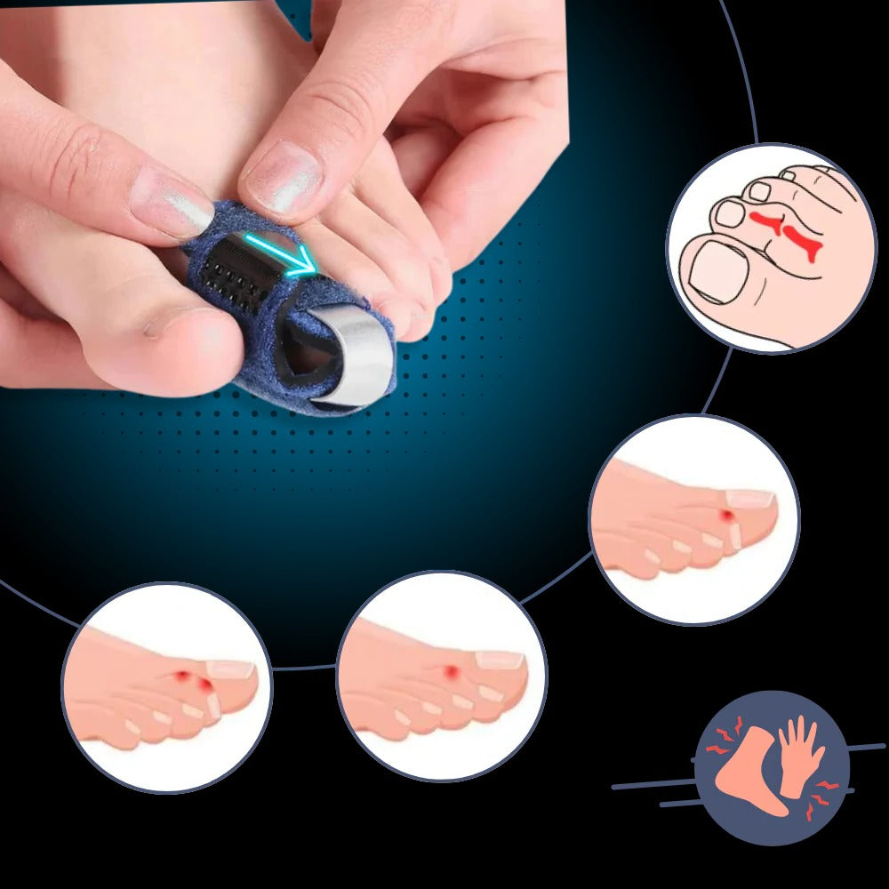 Toe Straightener with Adjustable Support | Practical, Beautiful & Built to Last — The Smart Choice for Any Home