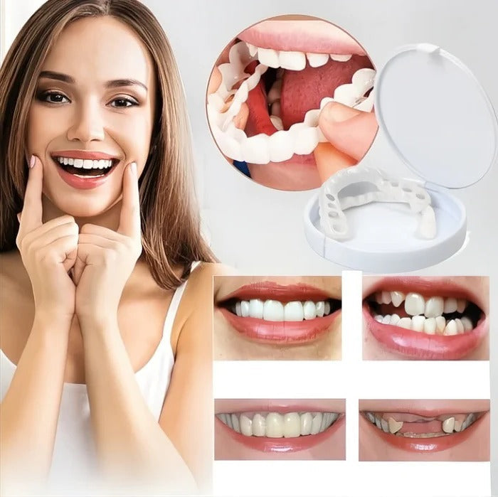 Veneers for Teeth with Natural White Finish | Effortlessly Functional Home Essential for Clean, Organised Living