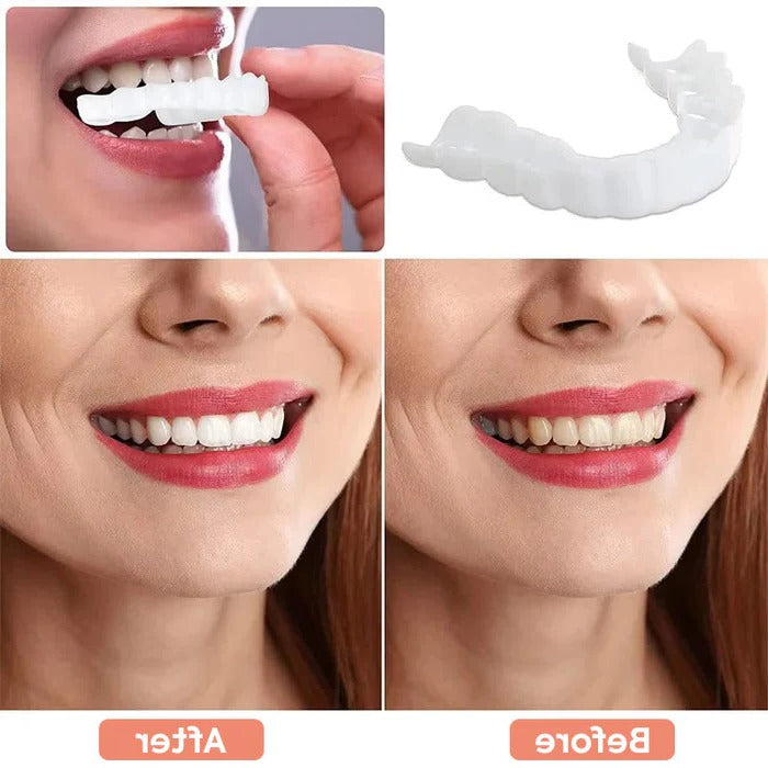 Veneers for Teeth with Natural White Finish | Effortlessly Functional Home Essential for Clean, Organised Living