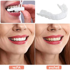Veneers for Teeth with Natural White Finish | Effortlessly Functional Home Essential for Clean, Organised Living
