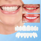 Veneers for Teeth with Natural White Finish | Effortlessly Functional Home Essential for Clean, Organised Living