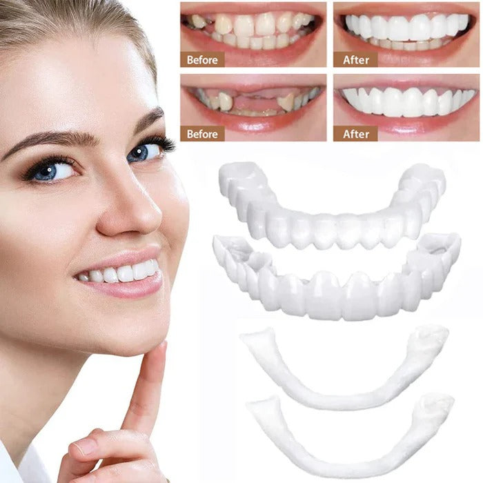 Veneers for Teeth with Natural White Finish | Effortlessly Functional Home Essential for Clean, Organised Living
