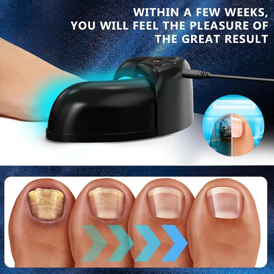 Nail Fungus Laser | Support Your Body, Reclaim Your Comfort & Move More Freely Every Day