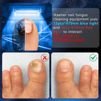 Nail Fungus Laser | Support Your Body, Reclaim Your Comfort & Move More Freely Every Day